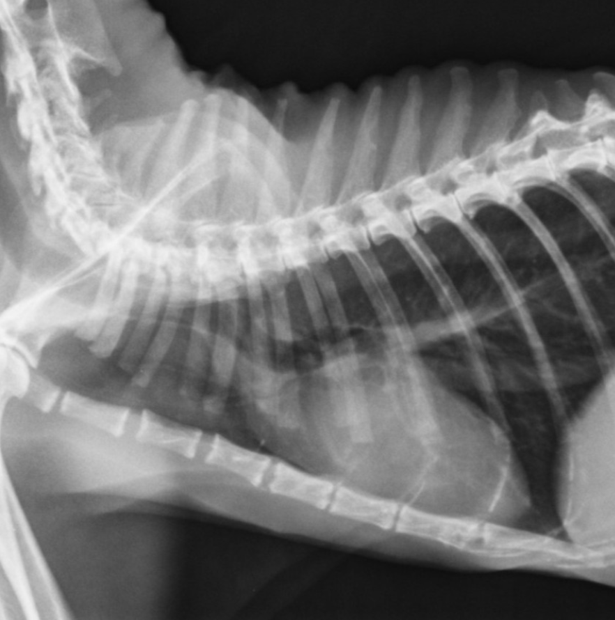 Radiographie numérique